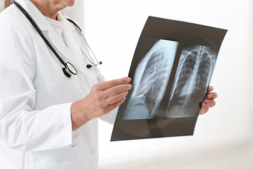 Radiografie-digitala