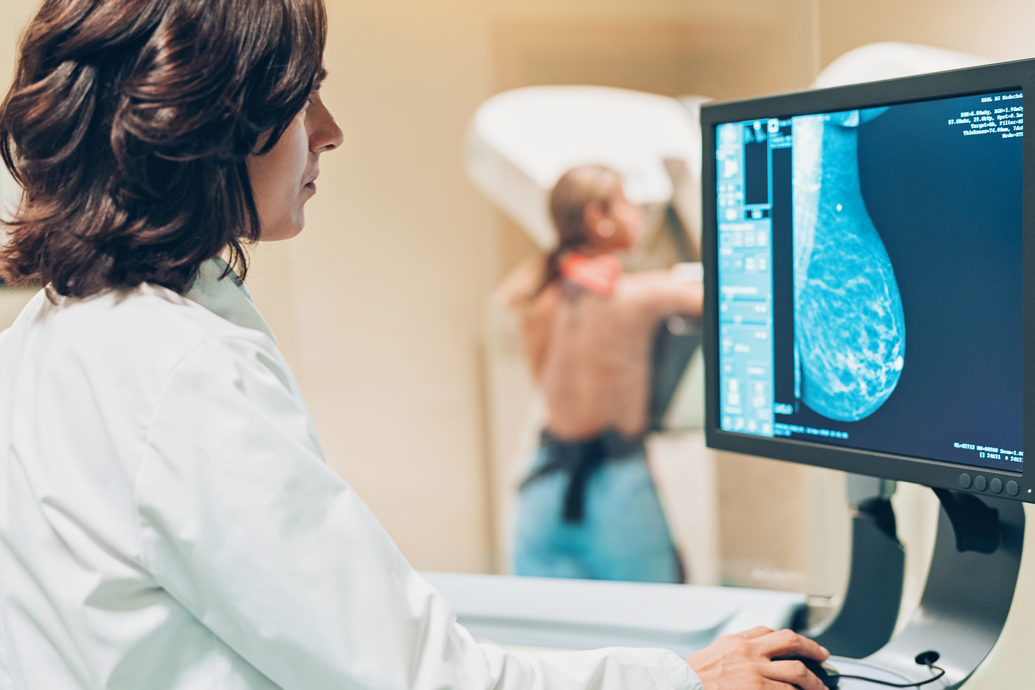 Mamografie Digitala 3D